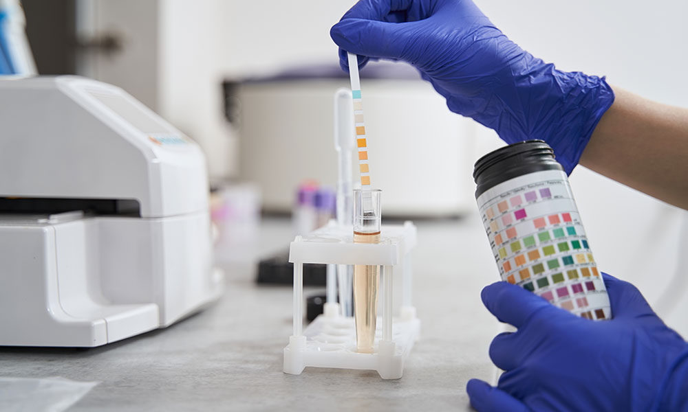 Testing in lab due to long PCP is stored in the body.