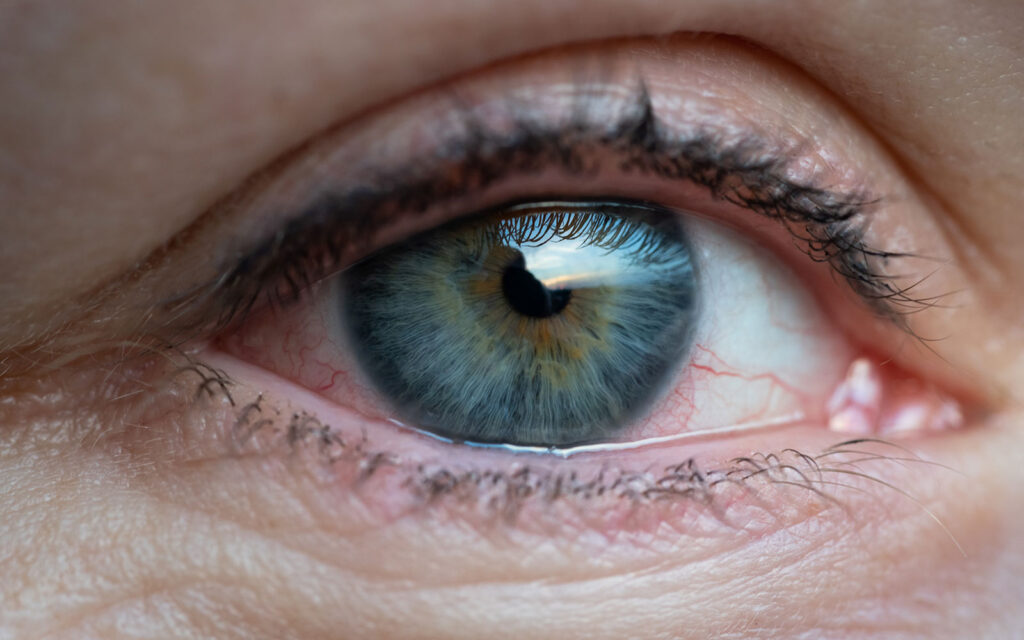 Drugs Can Make Your Pupils Bigger