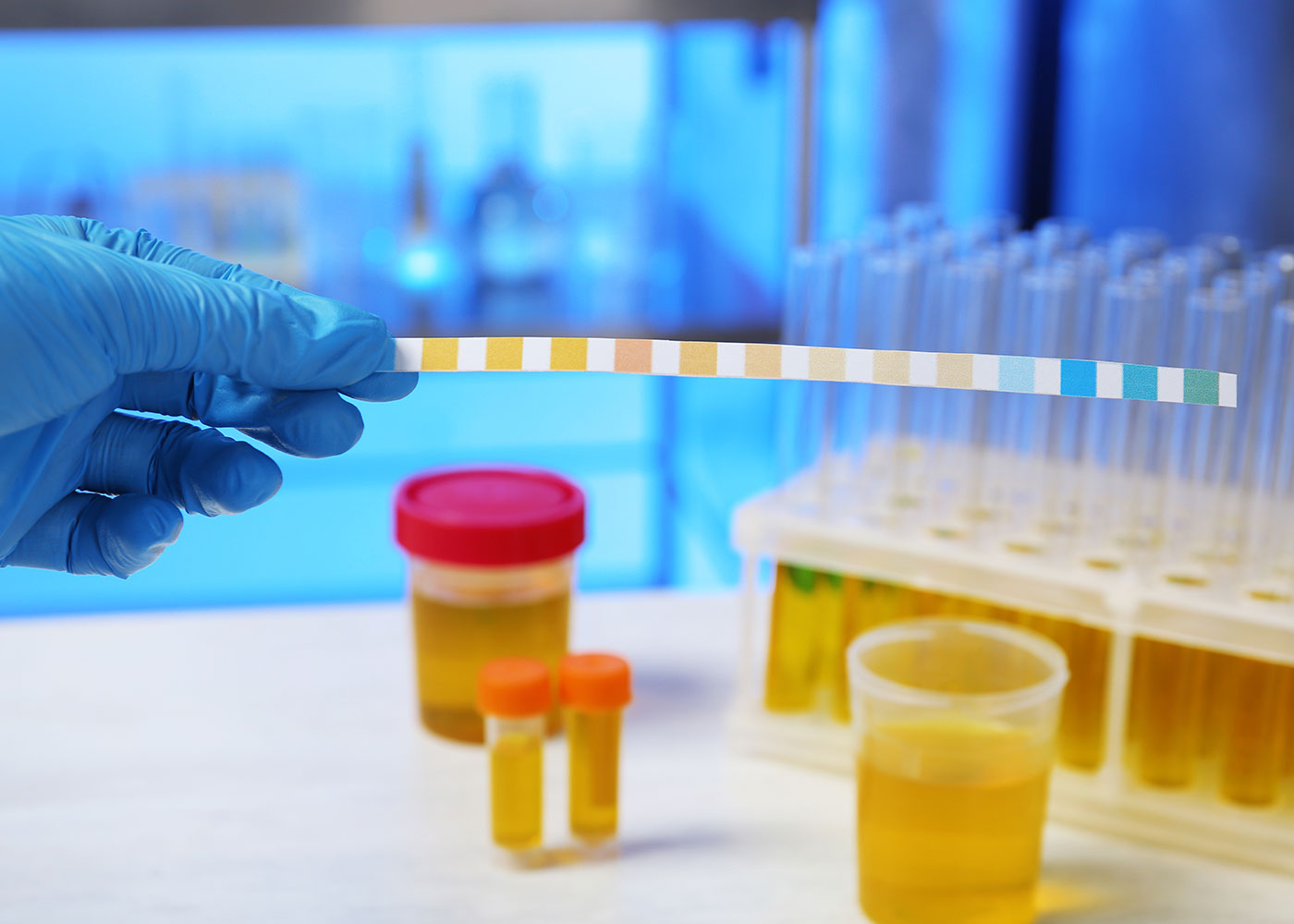 Urine tests typically detect substances longer than blood tests.