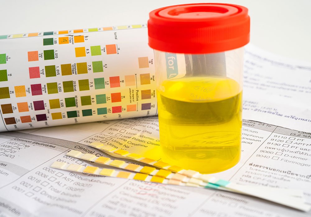 Adderall Show Up on a Urine Test